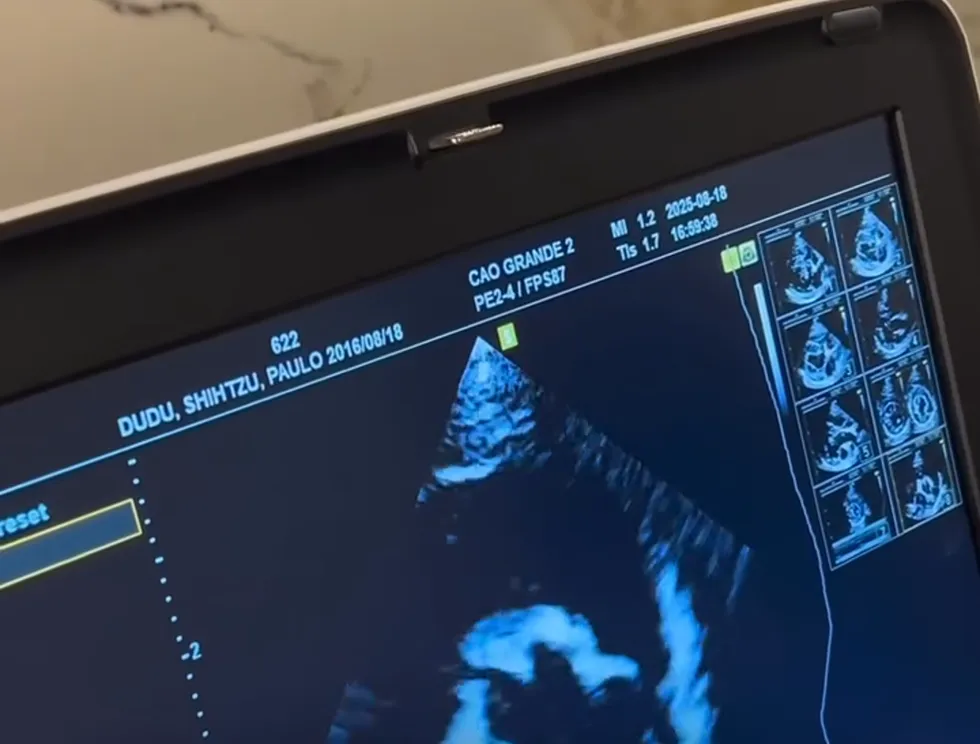 Tela do aparelho de ultrassom durante um ecodopplercardiograma na VitaeCor